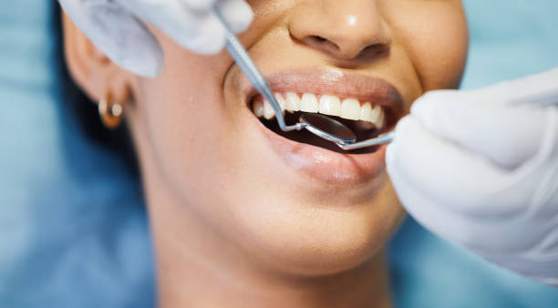 Best Emergency Gum Treatment in Glens Falls, NY